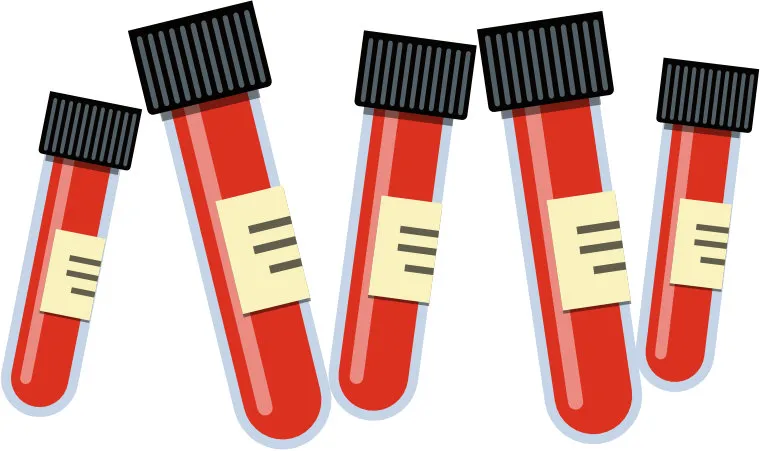 analisis-sangre-m2-l3d-3